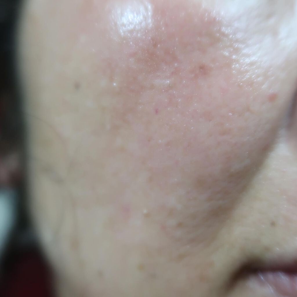 ミスクレオ on LIPS 「麗凍化粧品のホームページにクレンジングと洗顔が、あなたの肌を変..」(2枚目)