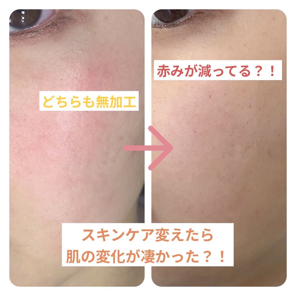 乳液・敏感肌用・さっぱりタイプ/無印良品/乳液を使ったクチコミ（1枚目）