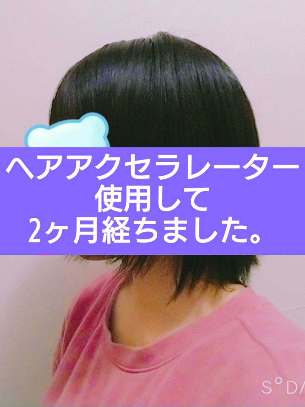 ヘアアクセルレーター レモンライムの香り/加美乃素本舗/頭皮ローションを使ったクチコミ（1枚目）