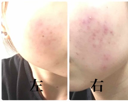 を使ったクチコミ(1枚目)