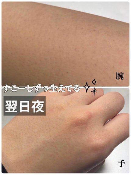 エピリムーバー/TBC/除毛クリームを使ったクチコミ(4枚目)