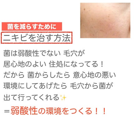 みん on LIPS 「肌荒れしてる方ならば1度は行ったことがあるであろう皮膚科につい..」(7枚目)