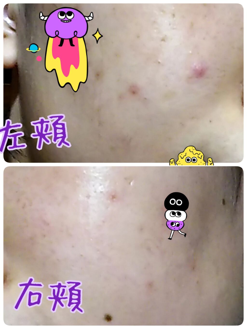 DHC ビタミンBミックス/DHC/美容サプリメントを使ったクチコミ（2枚目）