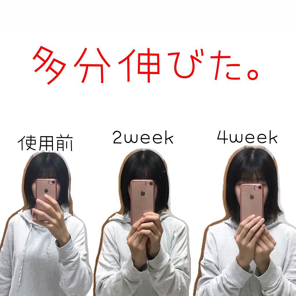 ヘアアクセルレーターEX フローラルアップルの香り/加美乃素本舗/頭皮ローションを使ったクチコミ(3枚目)