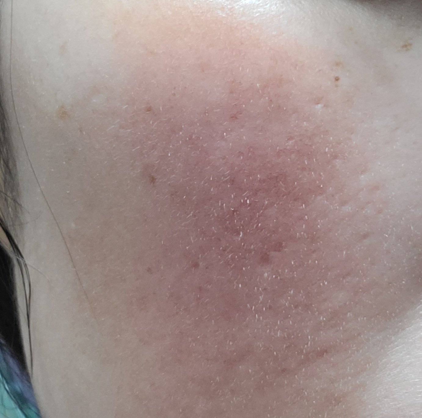 シカリニック HA バイオ エッセンス/CICALINIC/美容液を使ったクチコミ（3枚目）