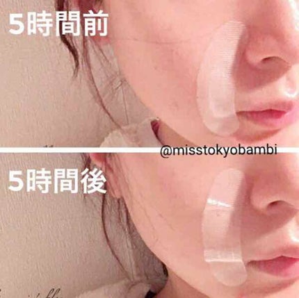 ヒアロディープパッチ/北の快適工房/シートマスク・パックを使ったクチコミ(3枚目)