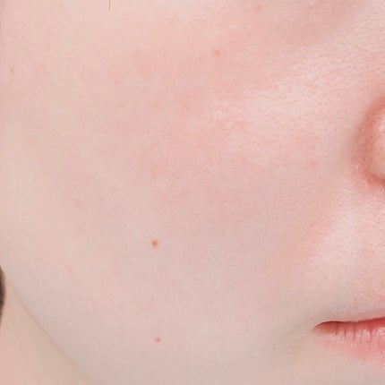 ピンクティーツリーカバークッション/APLIN/クッションファンデーションを使ったクチコミ(5枚目)