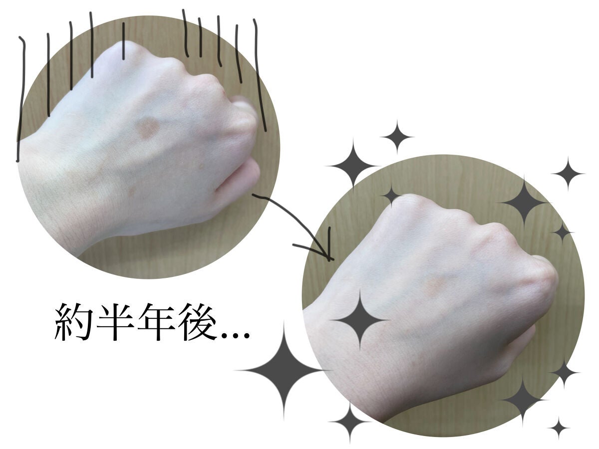 日本製エイジングケアアイクリームDX/DAISO/フェイスクリームを使ったクチコミ(1枚目)