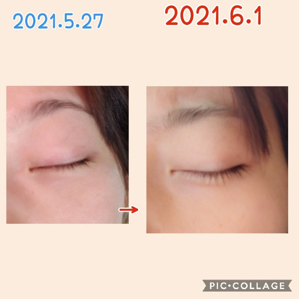 スカルプD ボーテ ピュアフリーアイラッシュセラム プレミアム/アンファー(スカルプD)/まつげ美容液を使ったクチコミ(2枚目)