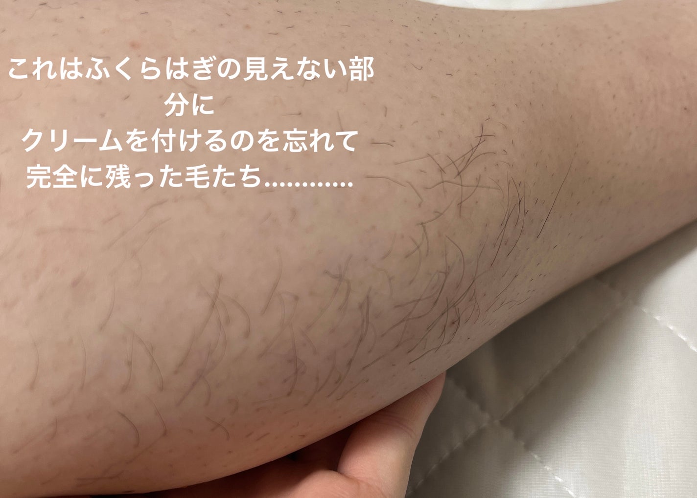 除毛クリーム 敏感肌用/エピラット/除毛クリームを使ったクチコミ(10枚目)