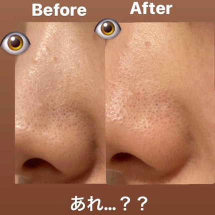 DETクリア ブライト&ピール ピーリングジェリー<無香料タイプ>/Detclear/ピーリングを使ったクチコミ(3枚目)