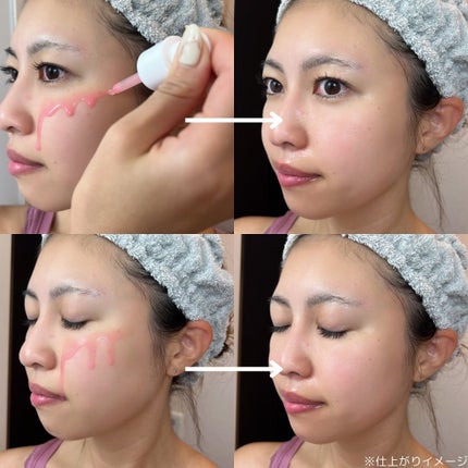 PDRNピンクアンプル PDRN 10,000ppm配合/MEDICUBE/美容液を使ったクチコミ(4枚目)