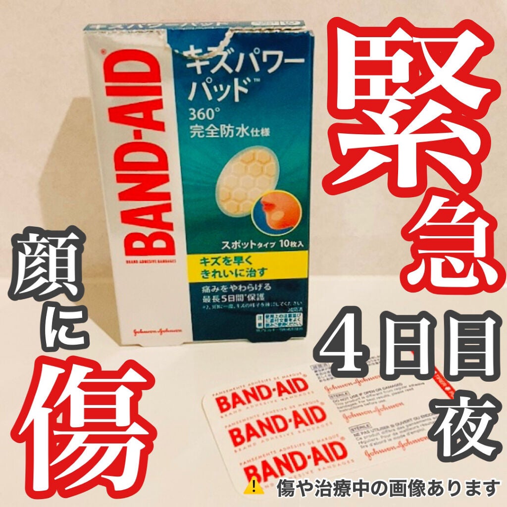 キズパワーパッド/バンドエイド/その他を使ったクチコミ(1枚目)