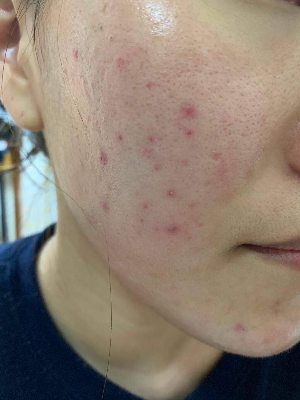 Tð on LIPS ãâŒïžãèŠèŠããåçãåºãŸãã®ã§ã泚æãã ããðââïžäžåŠçãã..ãïŒ4æç®ïŒ