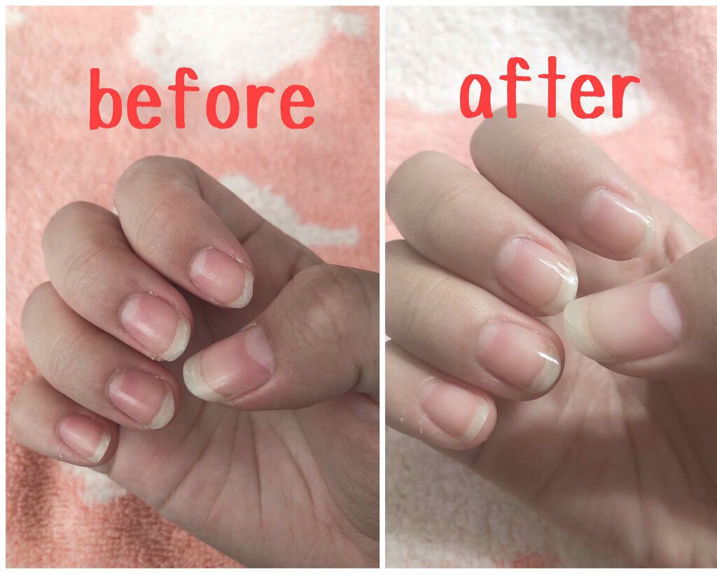 ネイルサポート Na/ネイルネイル/ネイルトップコートを使ったクチコミ（2枚目）