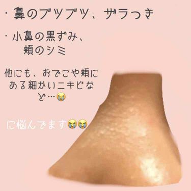 ホホバオイル 無印良品を使った口コミ 無加工の写真失礼します 写真の通り特に鼻 By こあら 敏感肌 10代後半 Lips