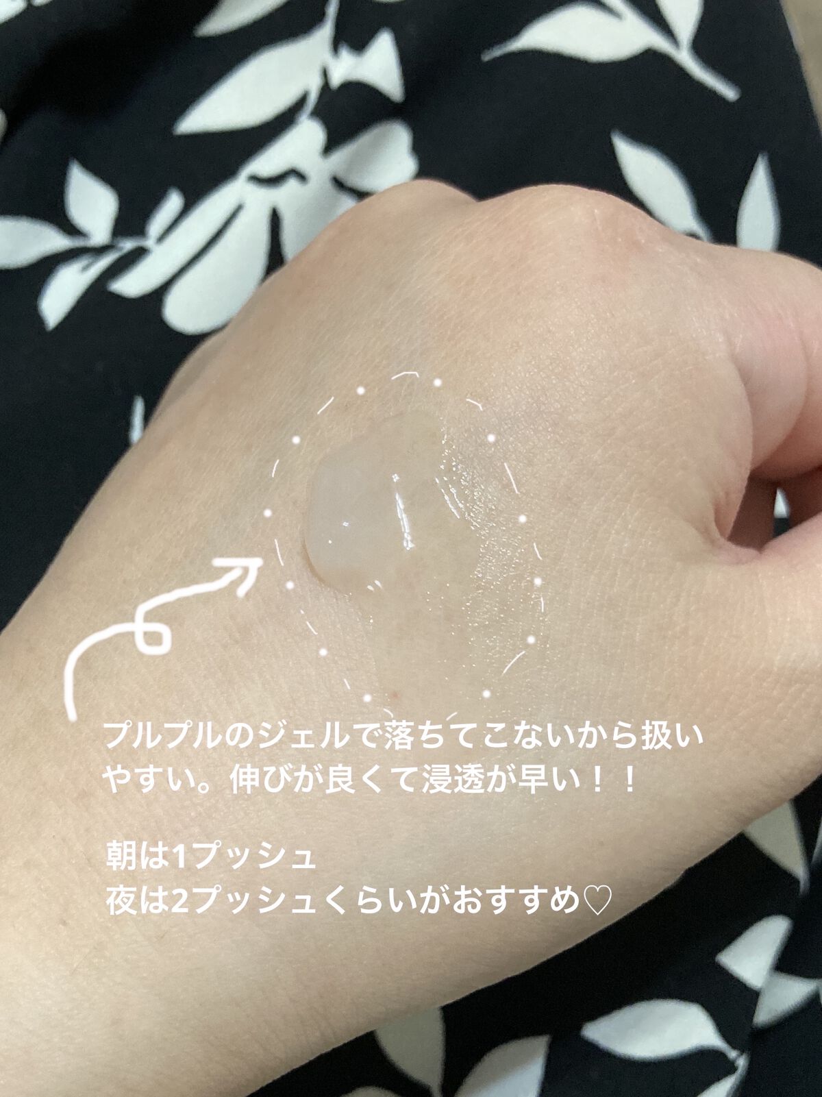 メディプラスゲル/メディプラス/オールインワン化粧品を使ったクチコミ（2枚目）