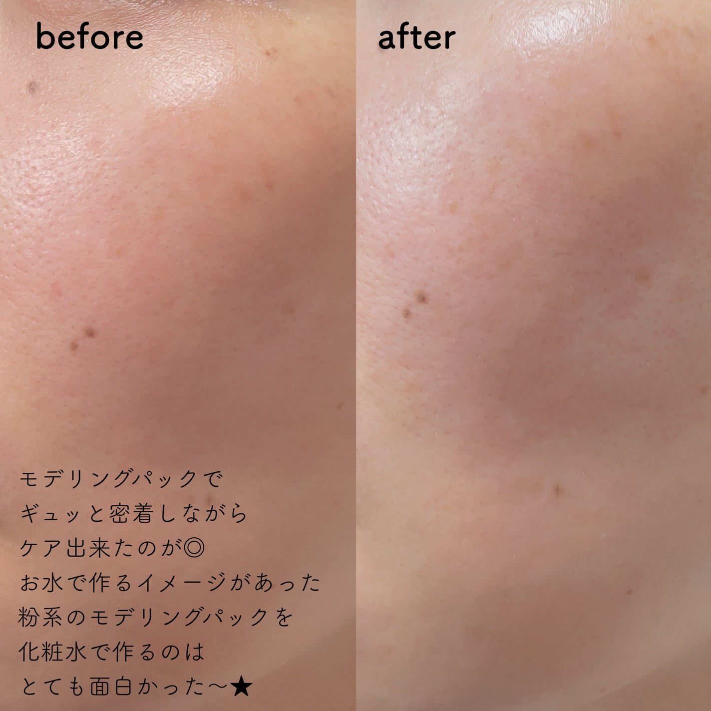 ドクダミ化粧水/ONE THING/化粧水を使ったクチコミ(4枚目)