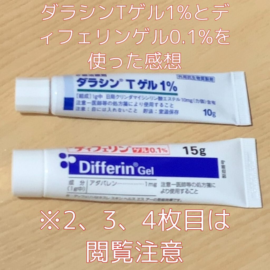 ダラシンTゲル 1% (医薬品)/佐藤製薬/その他を使ったクチコミ（1枚目）
