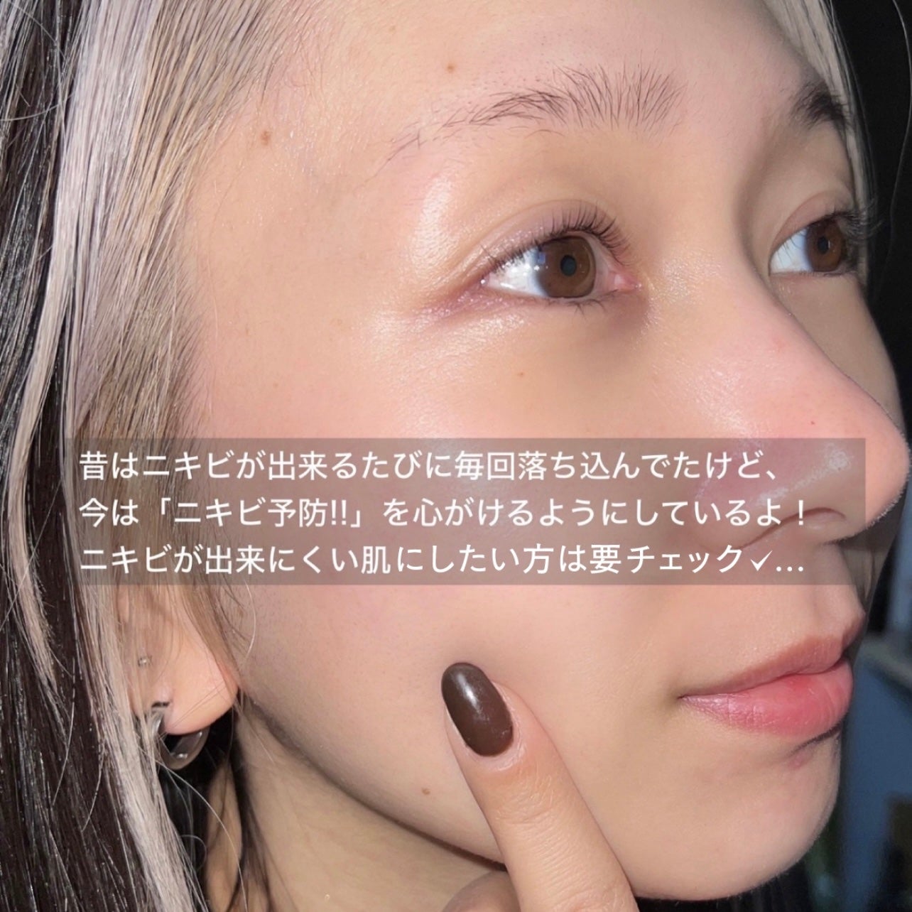 オードムーゲ 薬用ローション(ふきとり化粧水)/オードムーゲ/拭き取り化粧水を使ったクチコミ(5枚目)