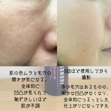 パンテショット675/COSNORI/美容液を使ったクチコミ(4枚目)