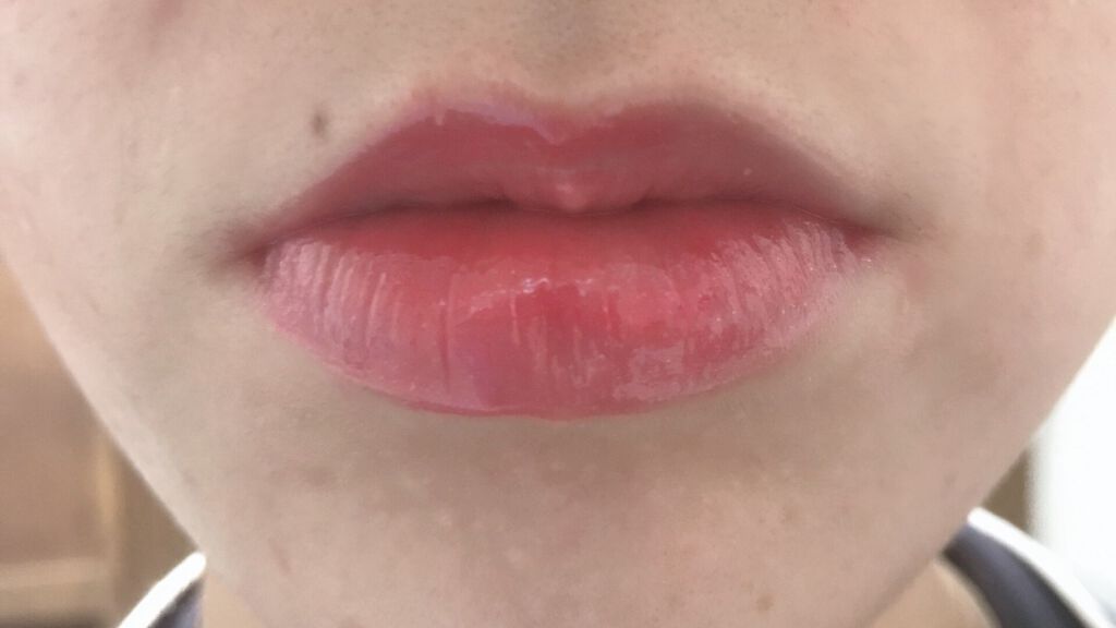 38°C / 99°F リップトリートメント (リップ美容液)/UZU BY FLOWFUSHI/リップケアを使ったクチコミ(2枚目)