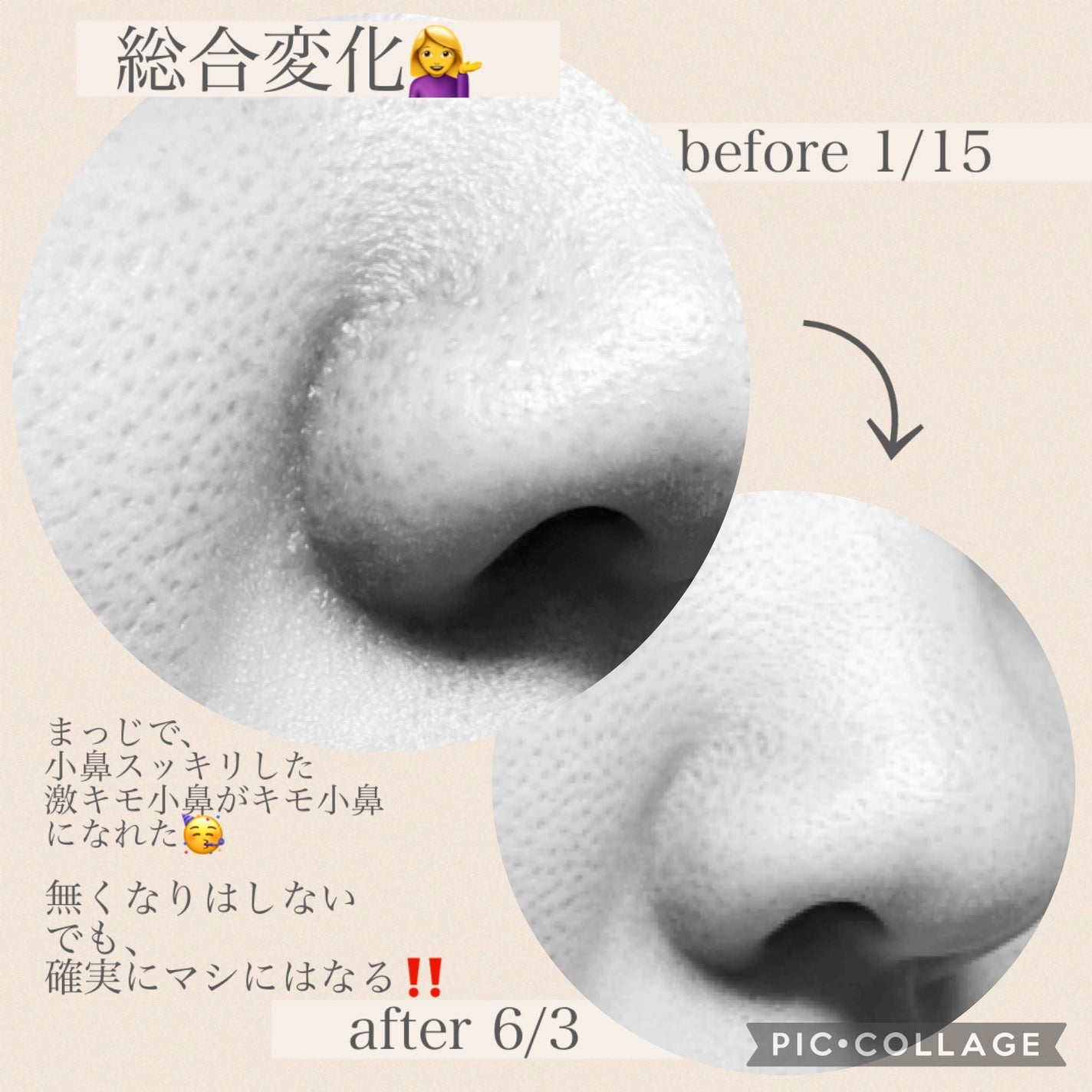 ケアセラ APフェイス&ボディ乳液/ケアセラ/ボディミルクを使ったクチコミ(5枚目)