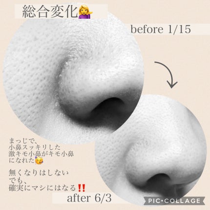 ケアセラ APフェイス&ボディ乳液/ケアセラ/ボディミルクを使ったクチコミ(5枚目)