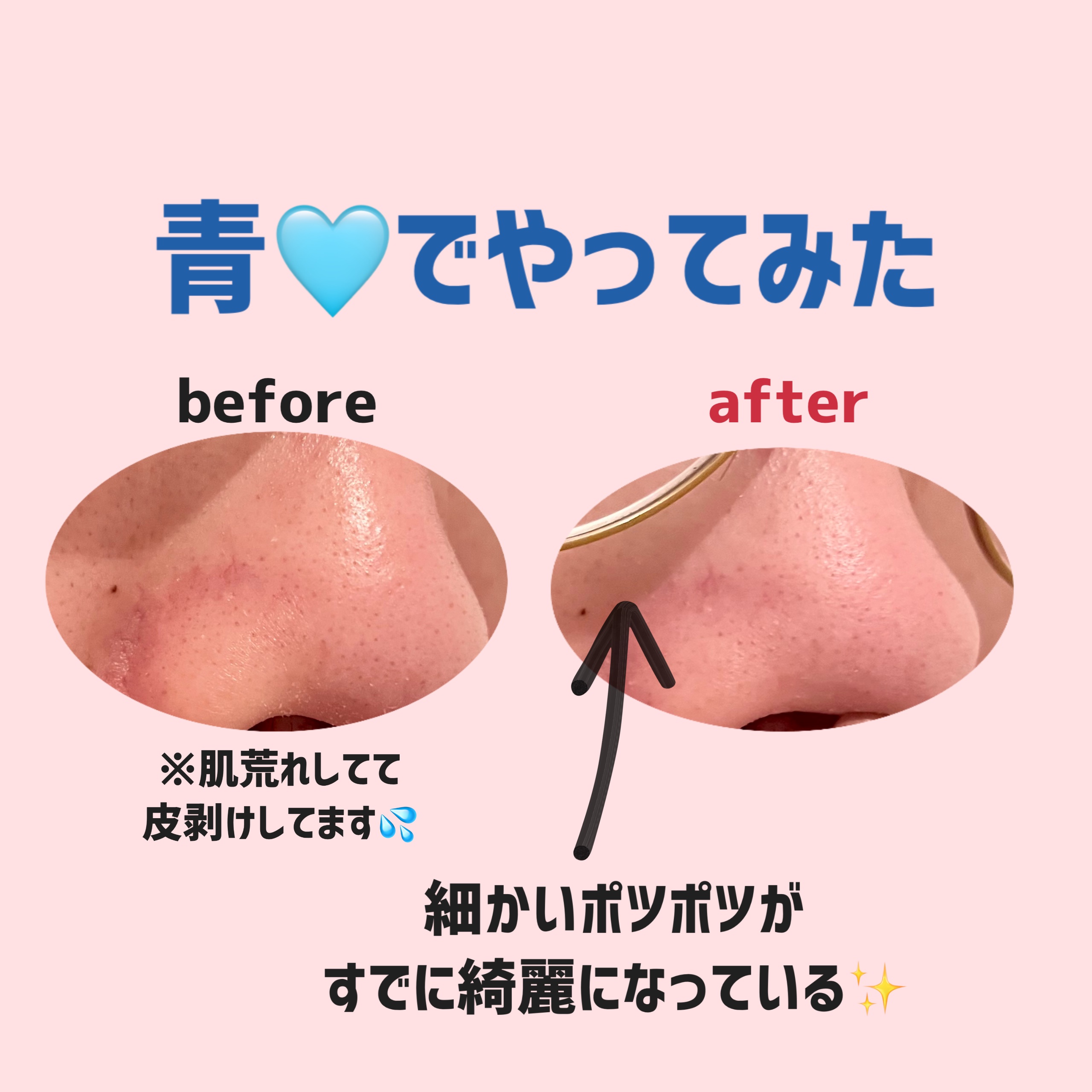 ロゼットゴマージュ クリアピール/ロゼット/スクラブ・ゴマージュを使ったクチコミ（2枚目）