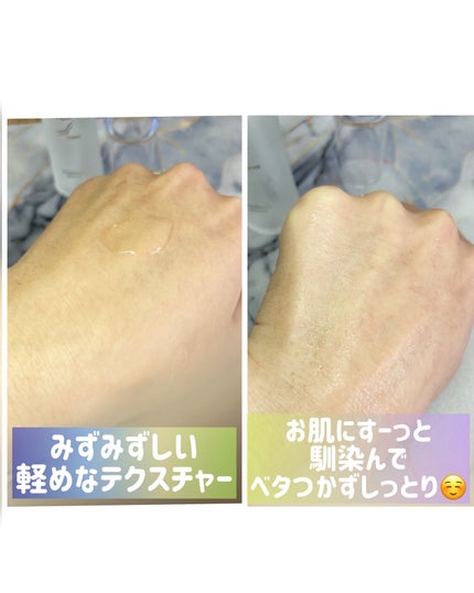 KYC★フォロバ120% on LIPS 「.\自宅で簡単にエイジングケア/@sora_246_様より🔶ブ..」(4枚目)