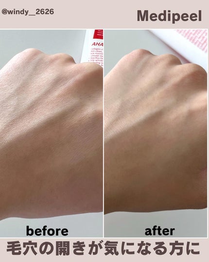 レッドラクトコラーゲンクレンジングオイル/MEDIPEEL/オイルクレンジングを使ったクチコミ(6枚目)