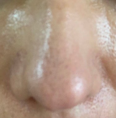 小鼻黒ずみケア

ケア開始10日後の小鼻

5回実施

角質を除去することは大切です。

1 炭酸泡洗顔で5分パック
洗い流す
2 洗顔料を塗布してブァッファローブラシで優しく圧をかけずにゆっくりくるく