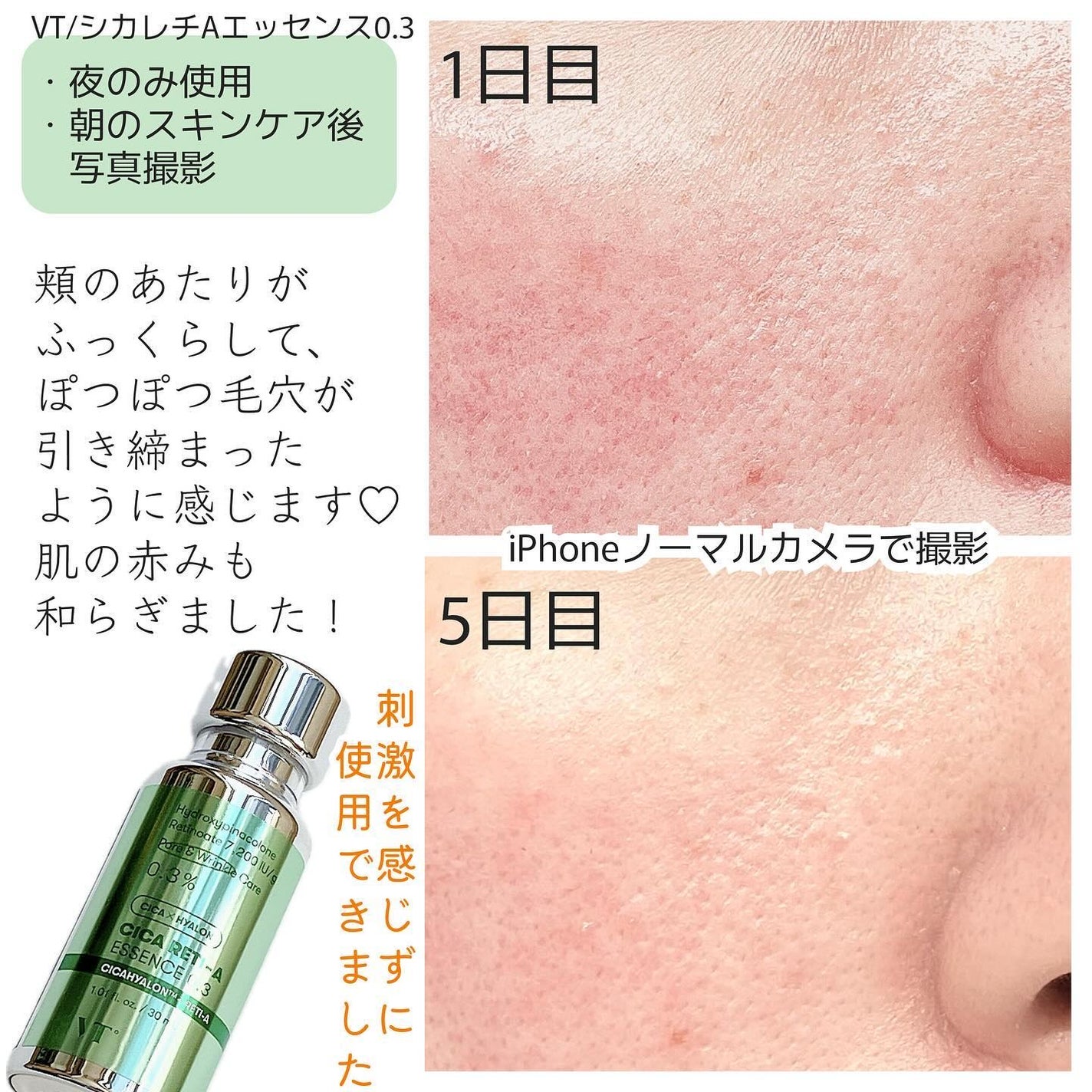 シカレチA エッセンス0.3/VT/美容液を使ったクチコミ(4枚目)