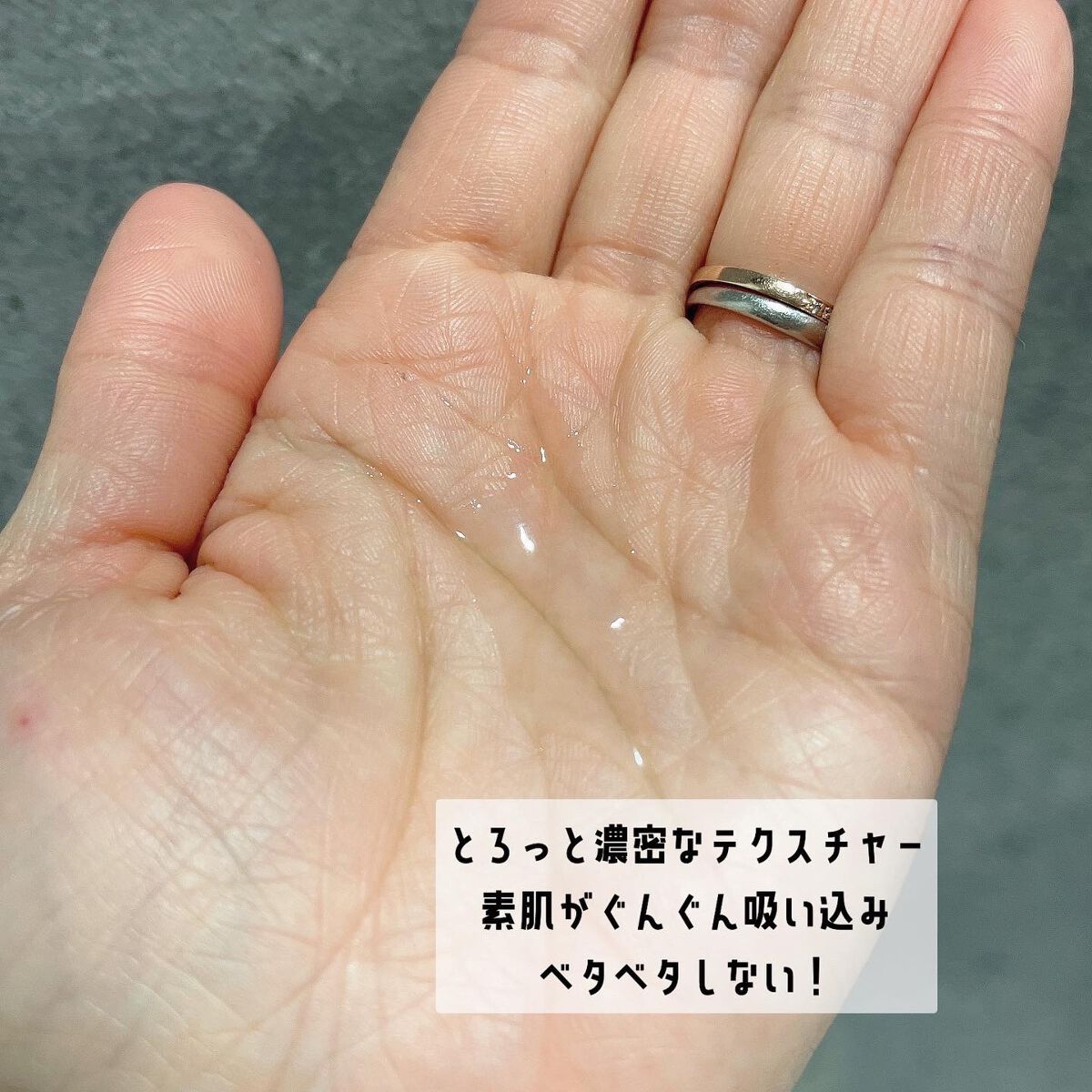 VC100エッセンスローション EX/ドクターシーラボⓇ/化粧水を使ったクチコミ（3枚目）