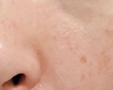 Cセラム/b.glen/美容液を使ったクチコミ(3枚目)