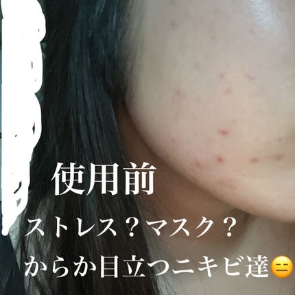 ルミエール ヴァイタルC/FEMMUE/ブースター・導入液を使ったクチコミ(4枚目)