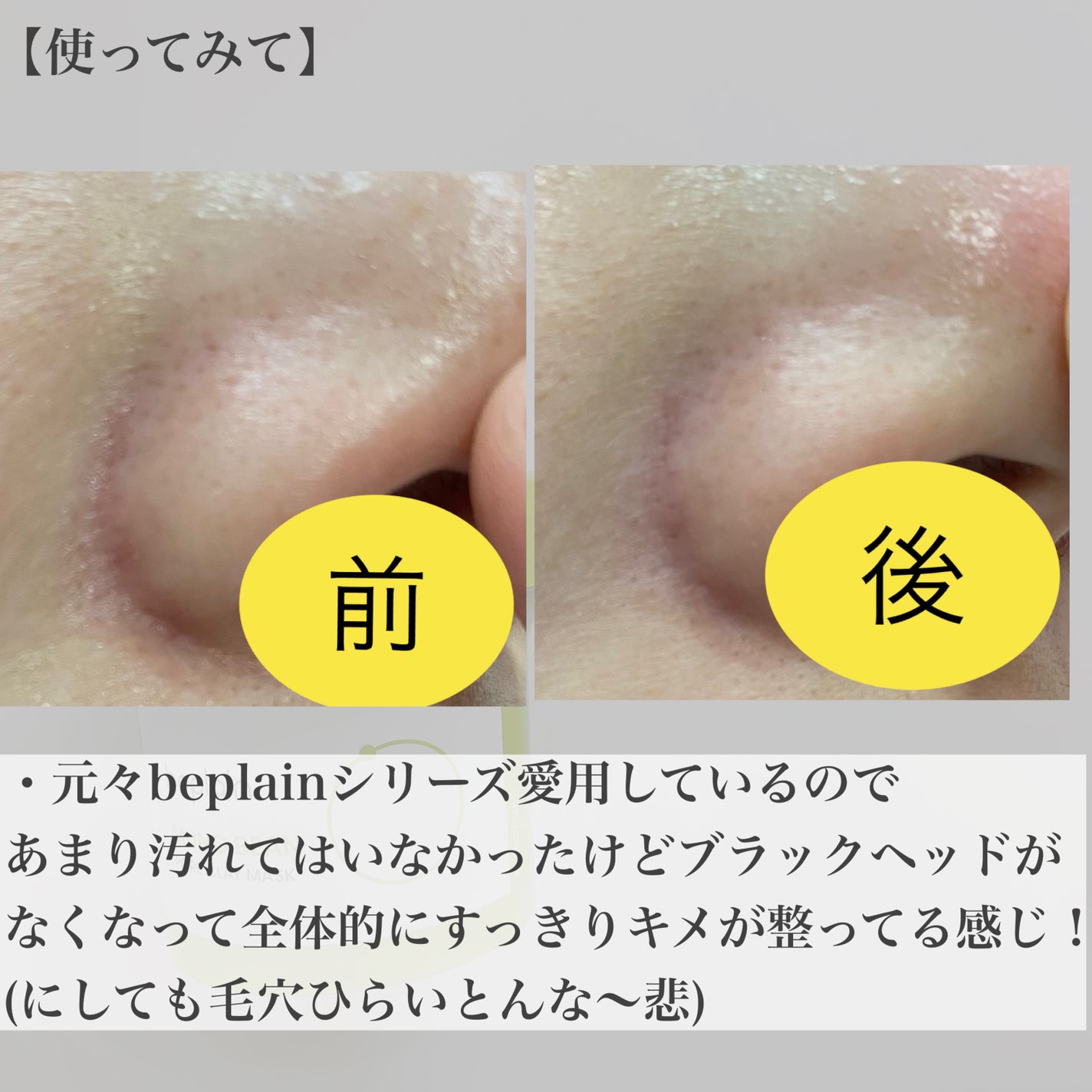 緑豆毛穴クレイパック/beplain/洗い流すパック・マスクを使ったクチコミ(5枚目)