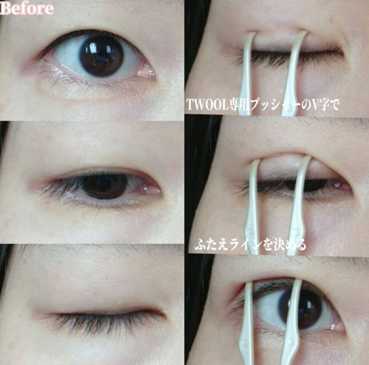 TWOOL ダブルアイリッドグルー/SHOBIDO/二重まぶた用アイテムを使ったクチコミ(5枚目)