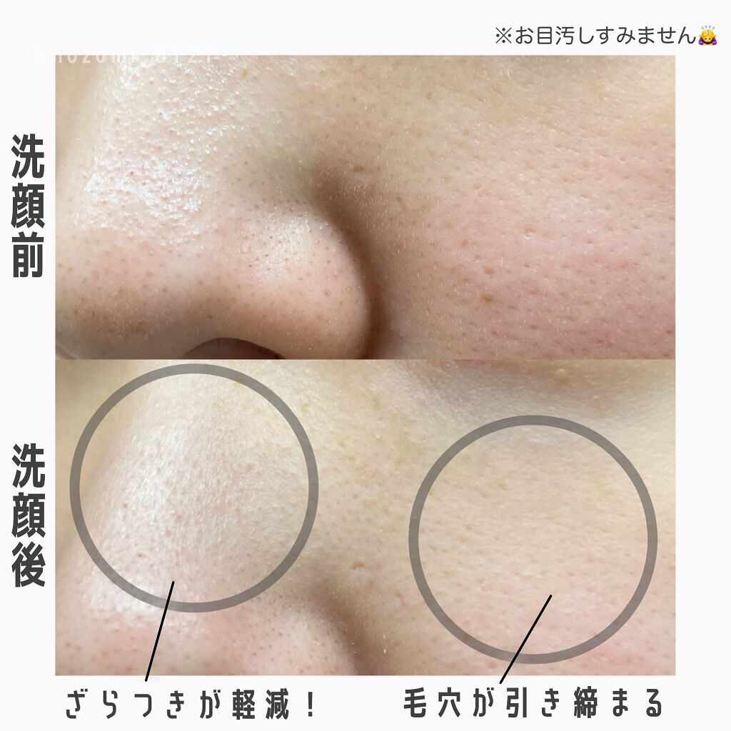 ダヴ すっきり毛穴ケア洗顔ジェル/ダヴ/洗顔フォームを使ったクチコミ(3枚目)