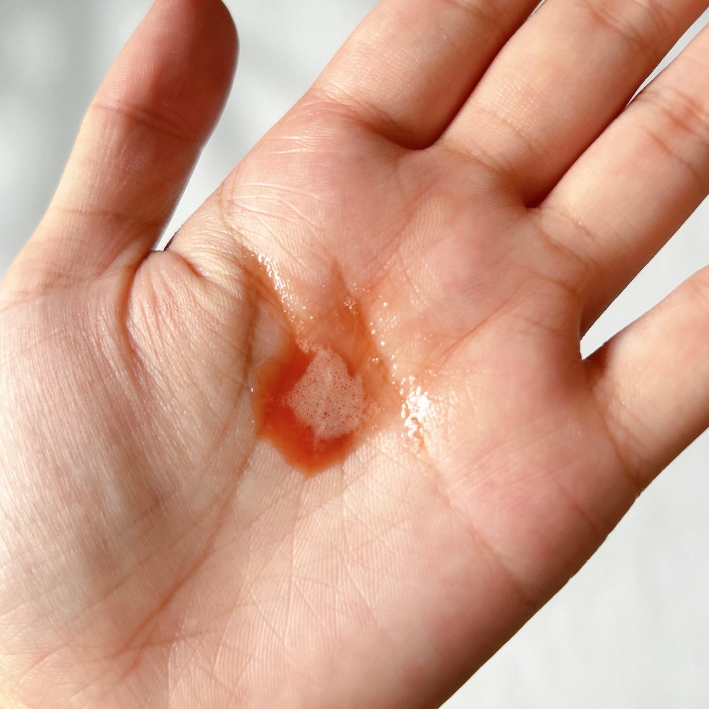 レッドアクネ ボディピーリングショット/MEDICUBE/ピーリングを使ったクチコミ(2枚目)