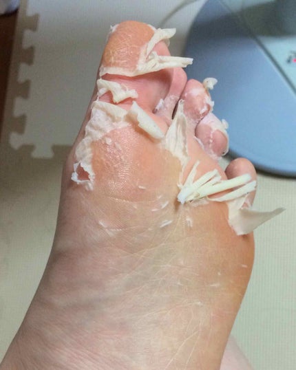 イージーパックDP60分タイプ/ベビーフット/レッグ・フットケアを使ったクチコミ(3枚目)