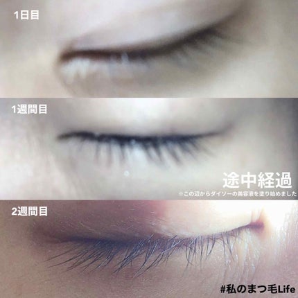 ローヤルゼリー配合 栄養ローション/DAISO/美容液を使ったクチコミ(4枚目)