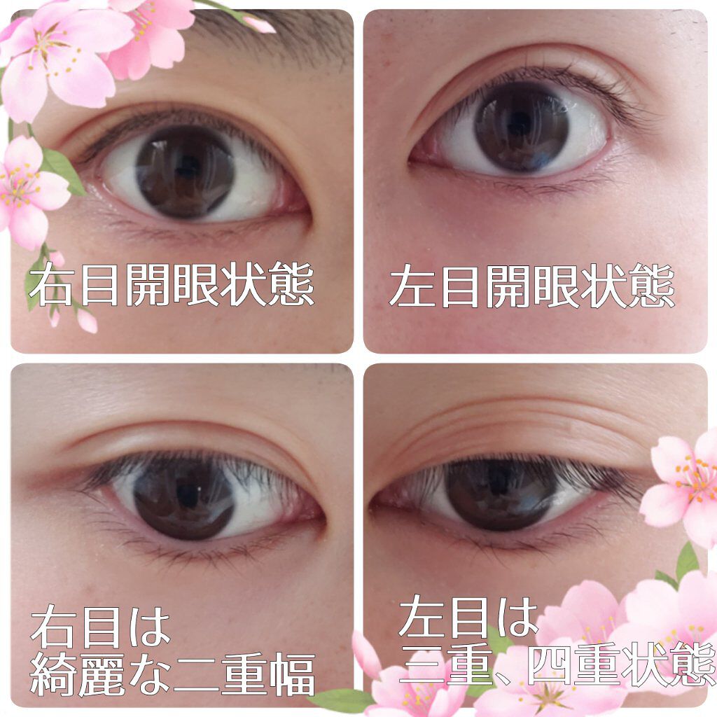 アイトーク スーパーウォータープルーフ/アイトーク/二重まぶた用アイテムを使ったクチコミ（2枚目）