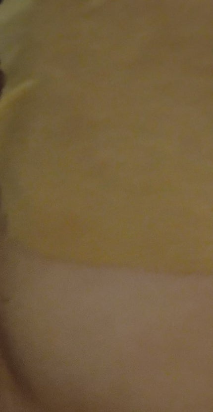 センテラ クイックカーミングパッド/SKIN1004/トナーパッドを使ったクチコミ(2枚目)