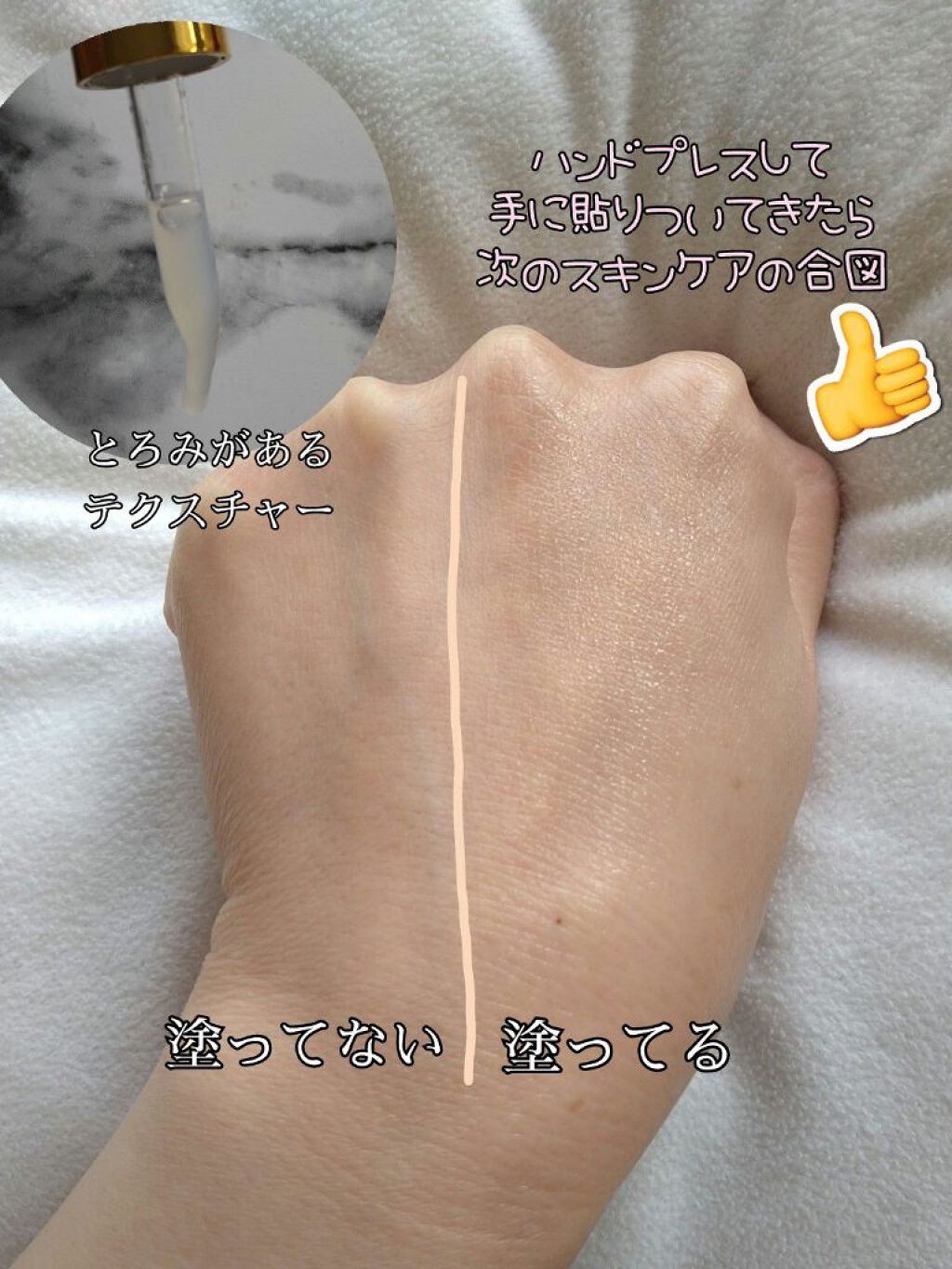 VC100ミルクピール プログラム1/ドクターシーラボⓇ/美容液を使ったクチコミ（2枚目）