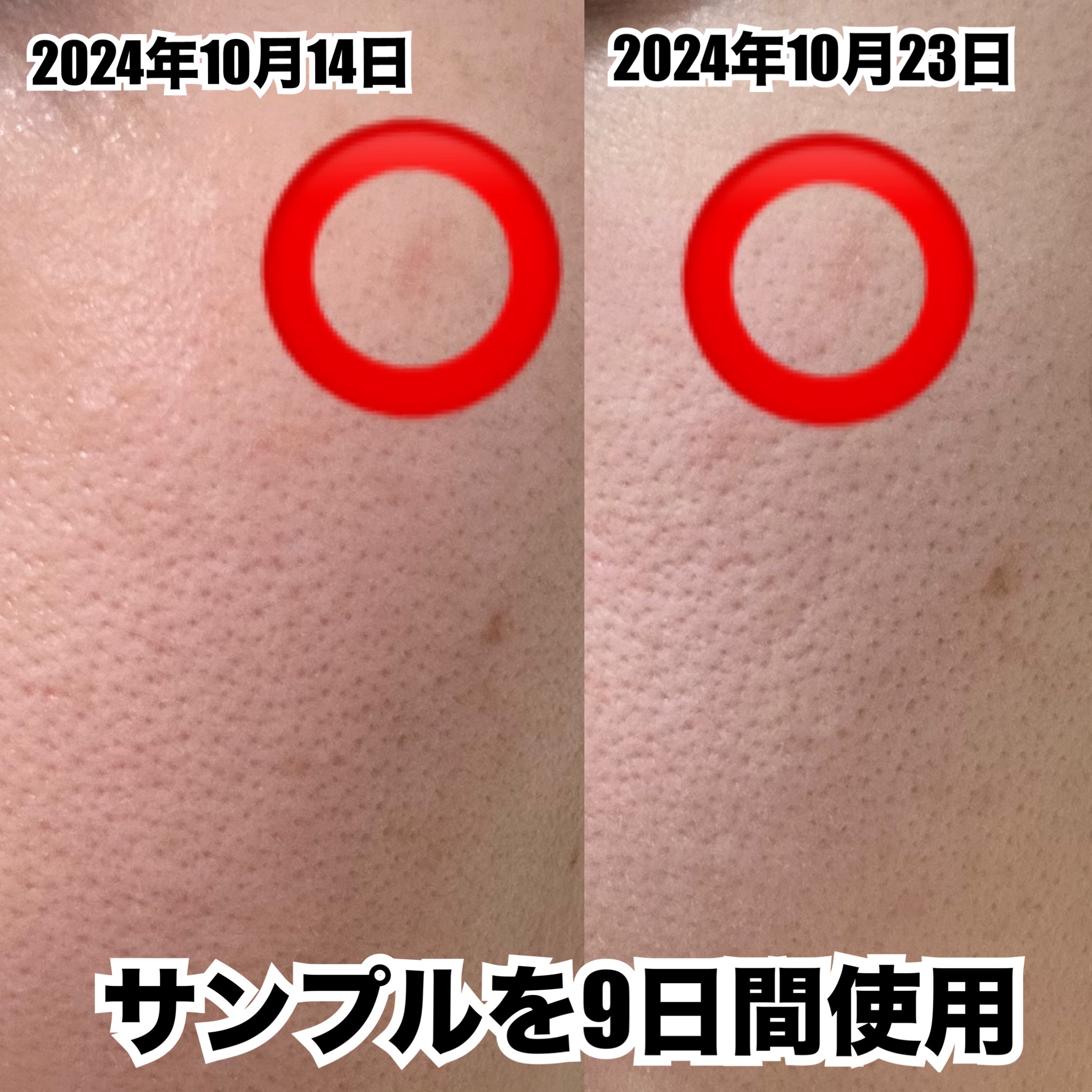 カプチュール トータル レチショット/Dior/美容液を使ったクチコミ（3枚目）