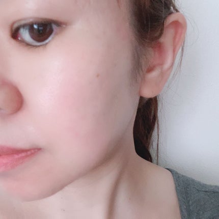 Derma Lift Mask/ALLUDEM/スキンケアキットを使ったクチコミ(9枚目)