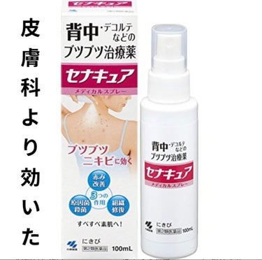 小林製薬 セナキュア(医薬品)のクチコミ「背中、腕、胸元のニキビがとても酷くて購入。

わたしは下着の肩紐に沿ってニキビがすごくできてい.....」（1枚目）