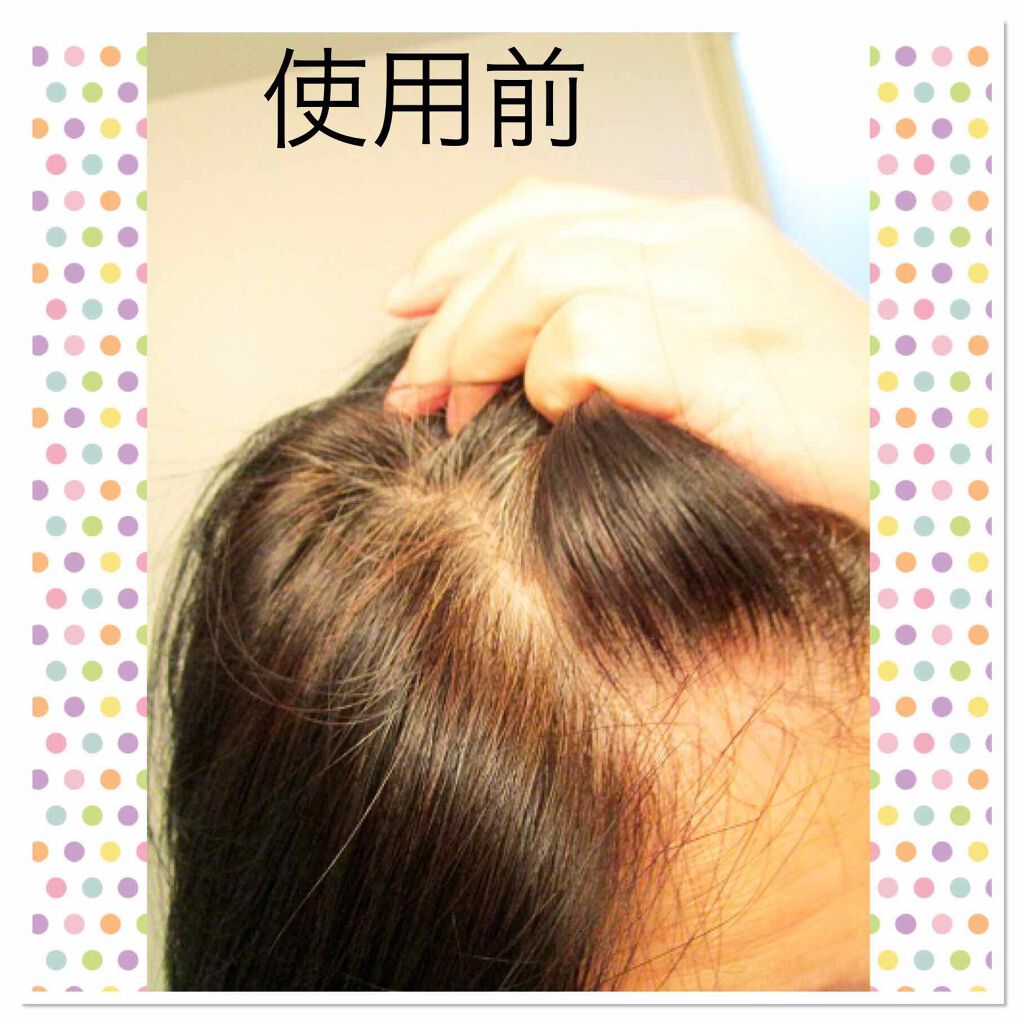 カラートリートメント/サイオス/ヘアカラーを使ったクチコミ（3枚目）