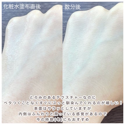 フルフィットプロポリスシナジートナー/COSRX/化粧水を使ったクチコミ(4枚目)